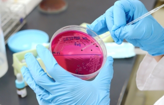 Wat is salmonella en hoe kan een uitbraak vermeden worden?